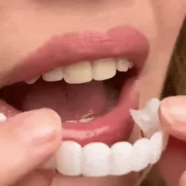 Zâmbet Instant Flex Veneer